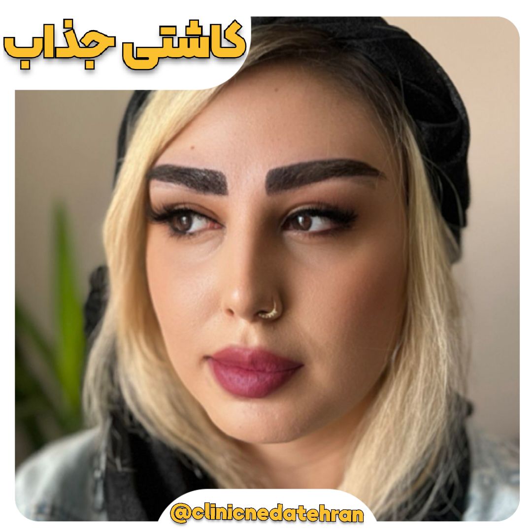 ابروهای شما، قابِ نگاهِ شماست! ✨